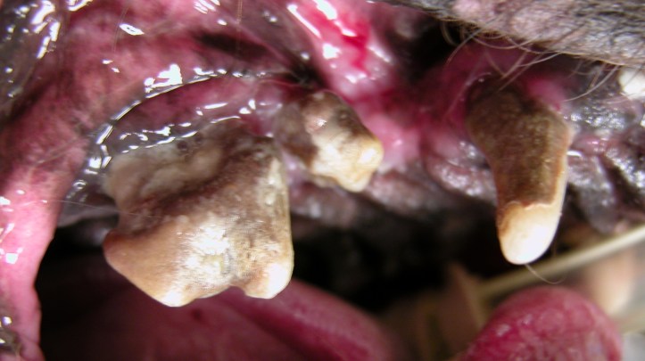 In this case of advanced periodontitis, there is major decay, attachment loss, and infection. 