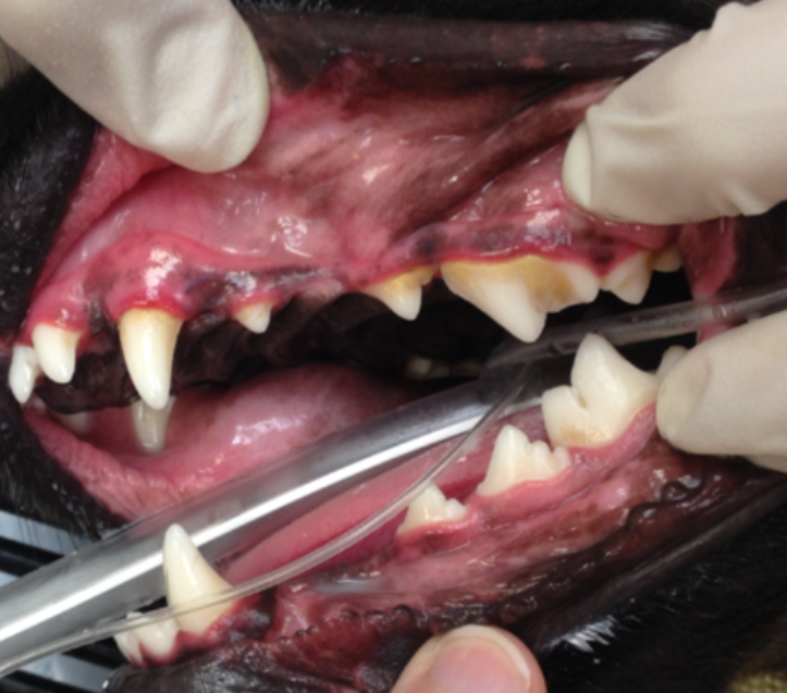 Early gingivitis is characterized by tartar build-up and inflammation at the gum line—the classic red line separating the crowns from the rest of the gum.