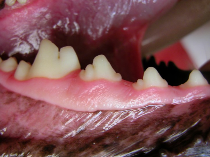 This is a very healthy mouth without any infection. The crowns are clean, there is no inflammation of the gums, and no infection below the gum line. Brushing will keep these teeth clean and the mouth healthy.