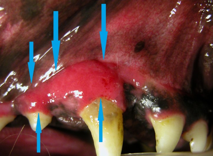 Early periodontitis is characterized by...